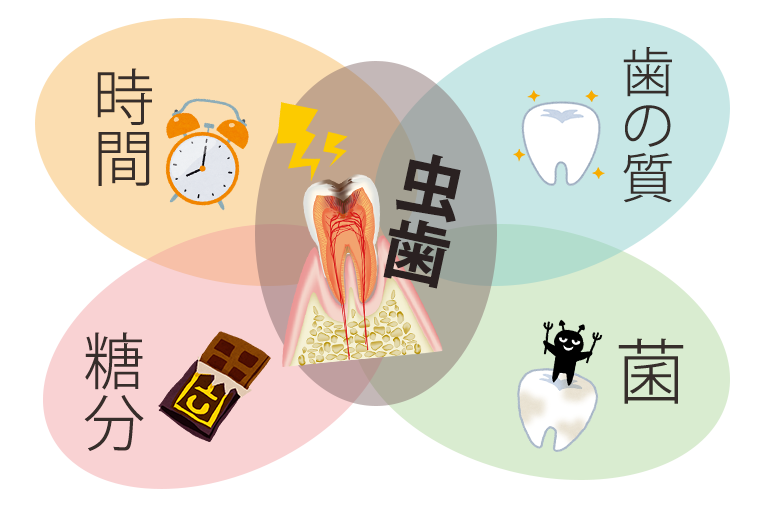 むし歯になる原因は？