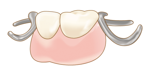 保険診療の入れ歯