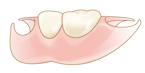 自費診療の入れ歯