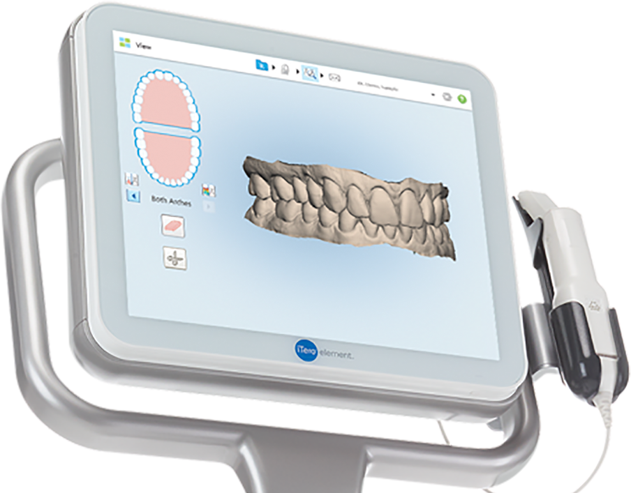 口腔内スキャナ―「iTero（アイテロ）」を導入